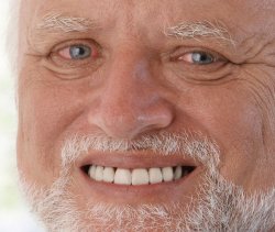 Hide the Pain Harold meme template